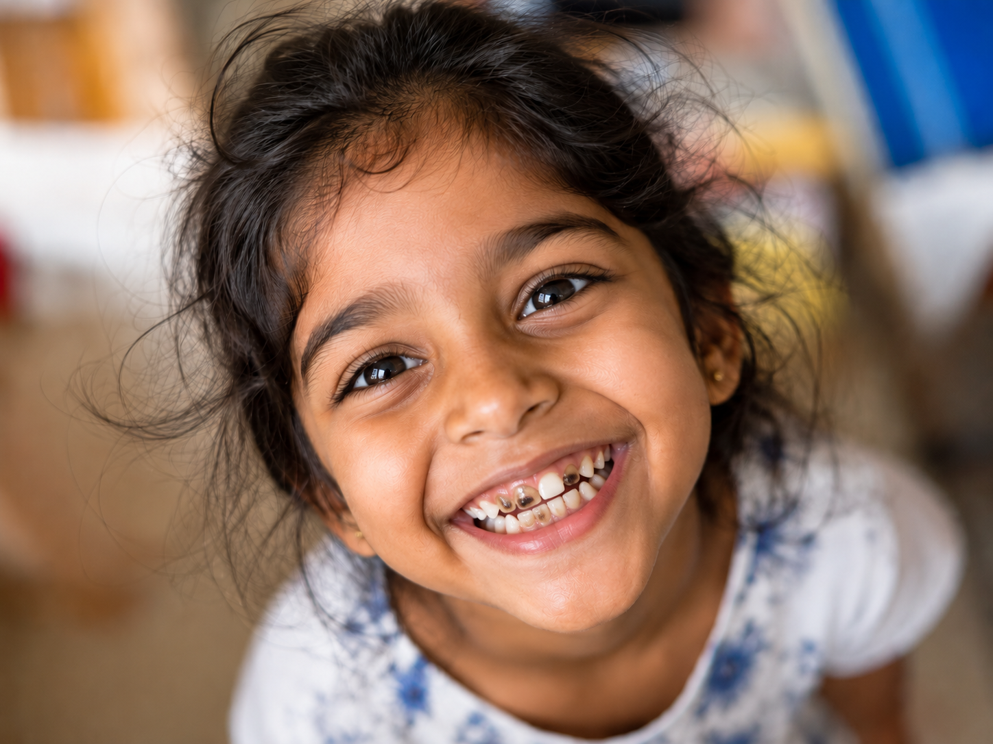 Kids Dentistry — before treatment